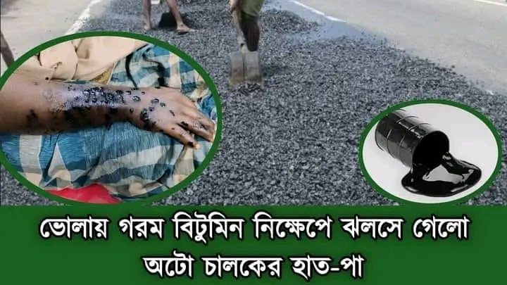 ভোলায় গরম বিটুমিন নিক্ষেপে ঝলসে গেলো অটো চালকের হাত-পা