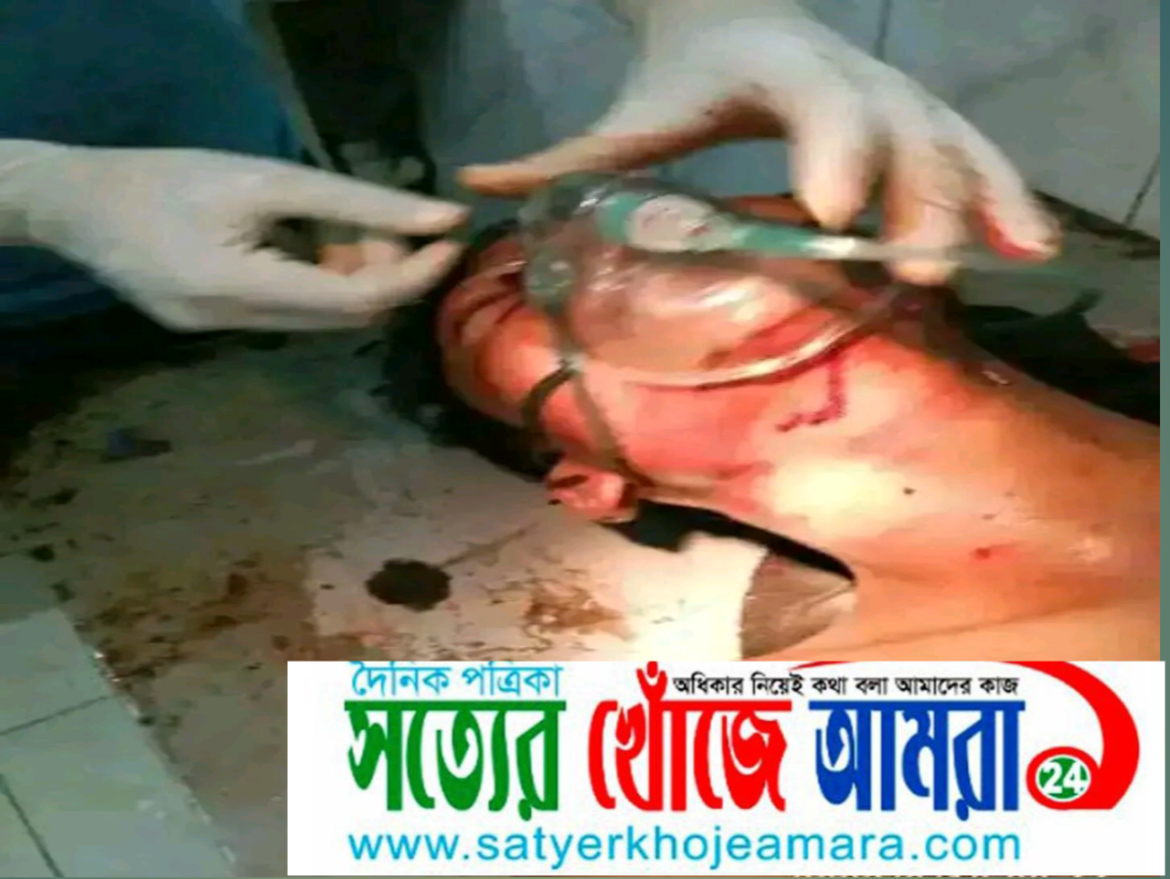 গংগাচড়ায় মোটরসাইকেল ও চার্জার ভ‍্যানের মুখোমুখি সংঘর্ষে গুরুতর আহত অবস্থায় রংপুর মেডিকেল কলেজ ভর্তি।